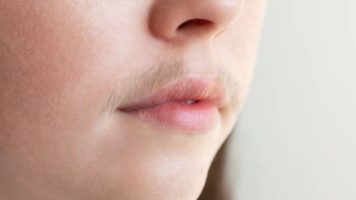 Facial Hair Remedies: முகத்தில் உள்ள முடி இருந்த இடம் தெரியாமல் போக இந்த ரெமிடிஸ் யூஸ் பண்ணுங்க