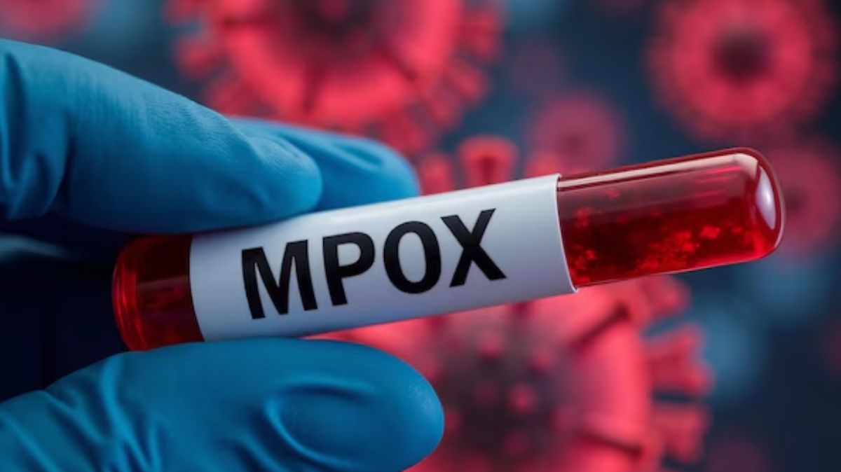 இப்படி தான் Mpox பரவுது.. ஜாக்கிரதை.!