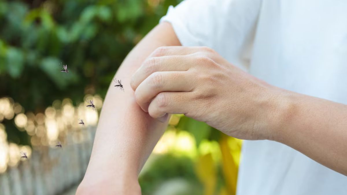 Mosquito Bites Remedies: கொசுக்கடி அரிப்பை ஆற்றும் சூப்பரான வீட்டுவைத்தியங்கள் இதோ!