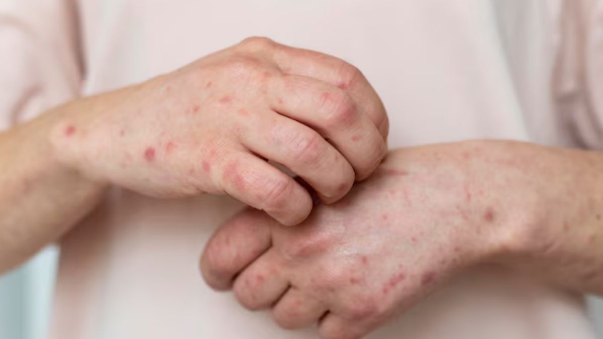 Itchy Skin: தோல் அடிக்கடி அரிக்கிறதா? காரணமும், வீட்டு வைத்தியமும்!