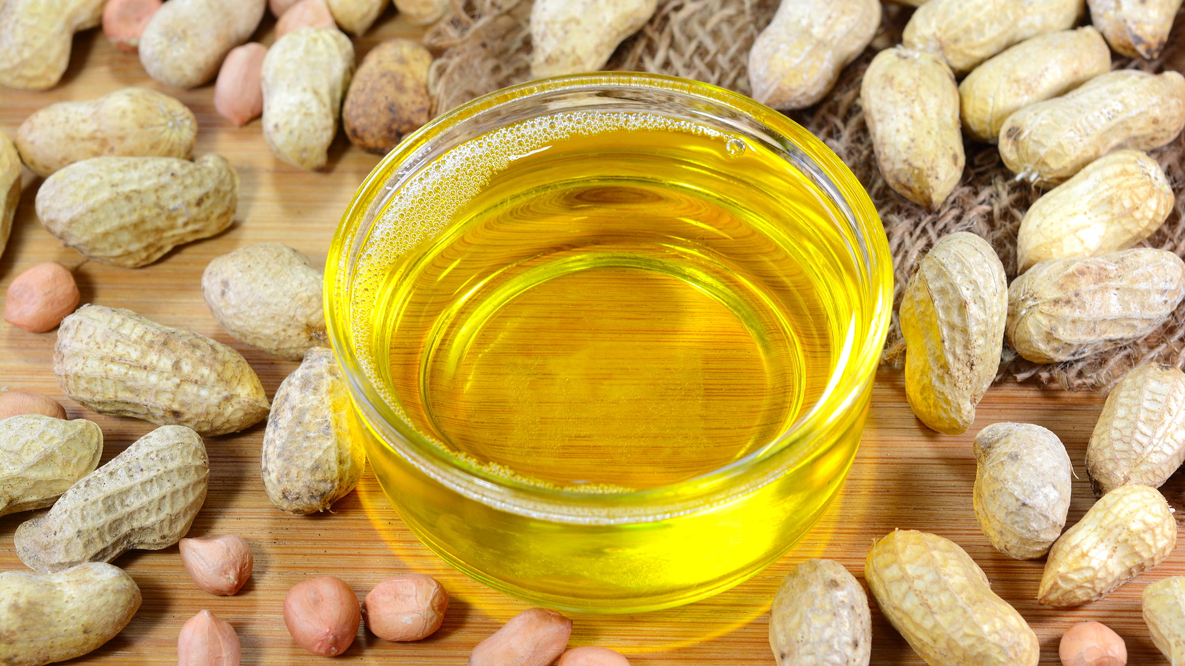 Is Peanut Oil Healthy: கொலஸ்ட்ரால் உள்ளவர்கள் கடலை எண்ணெய் சாப்பிடலாமா? நிபுணர்கள் கூறுவது இங்கே!