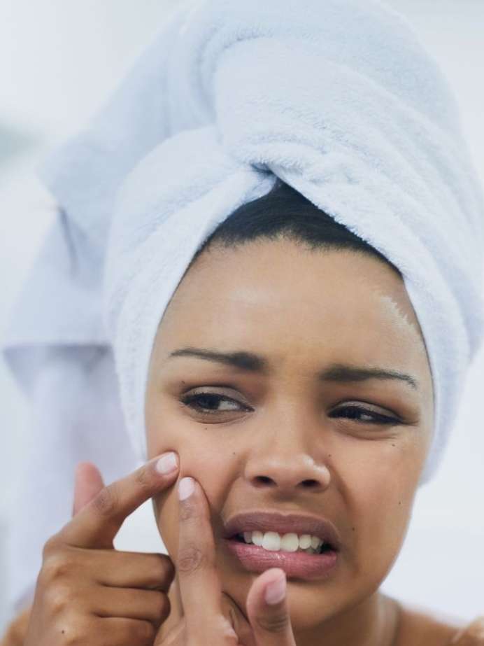 Image showcasing 5 foods that can contribute to acne | Curology