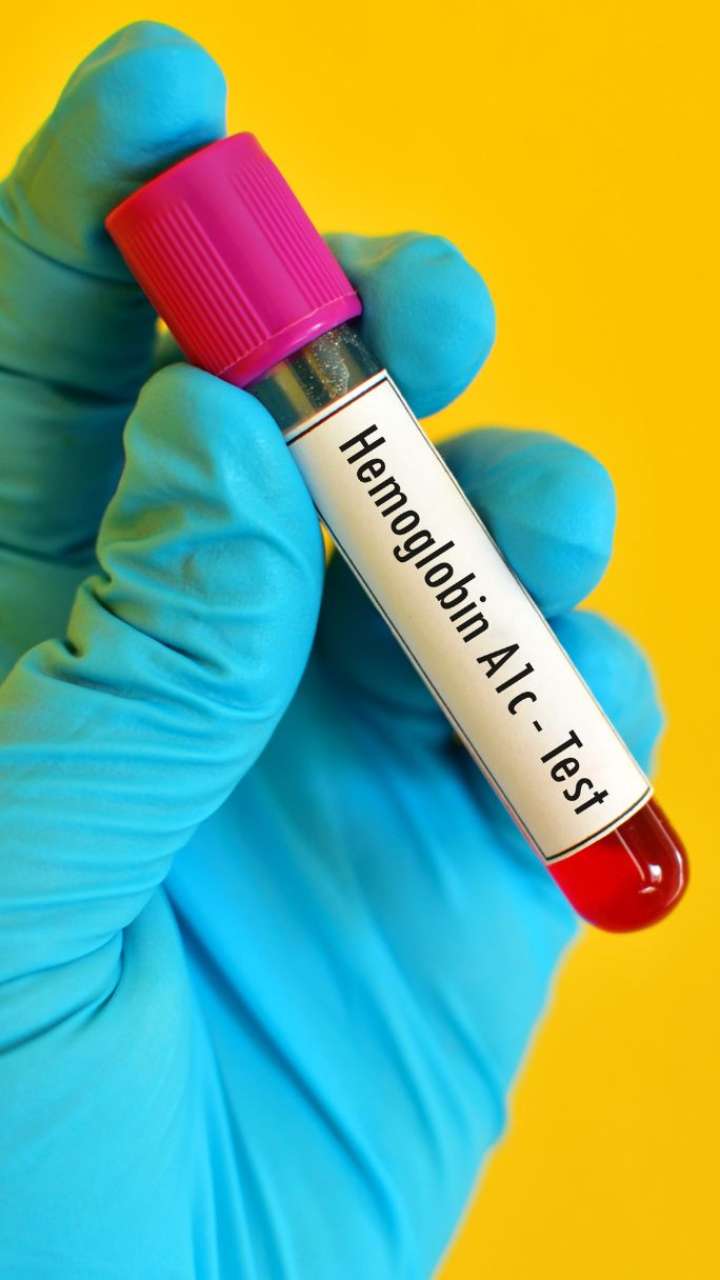 7-natural-ways-to-increase-haemoglobin-levels
