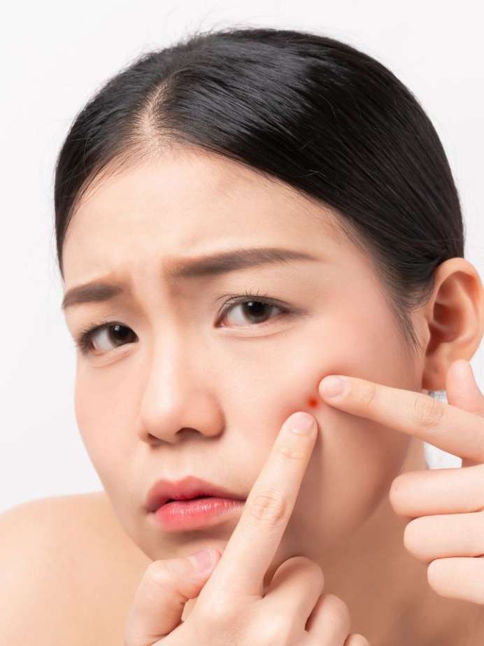 Can A Dirty Pillowcase Cause Pimples? Onlymyhealth
