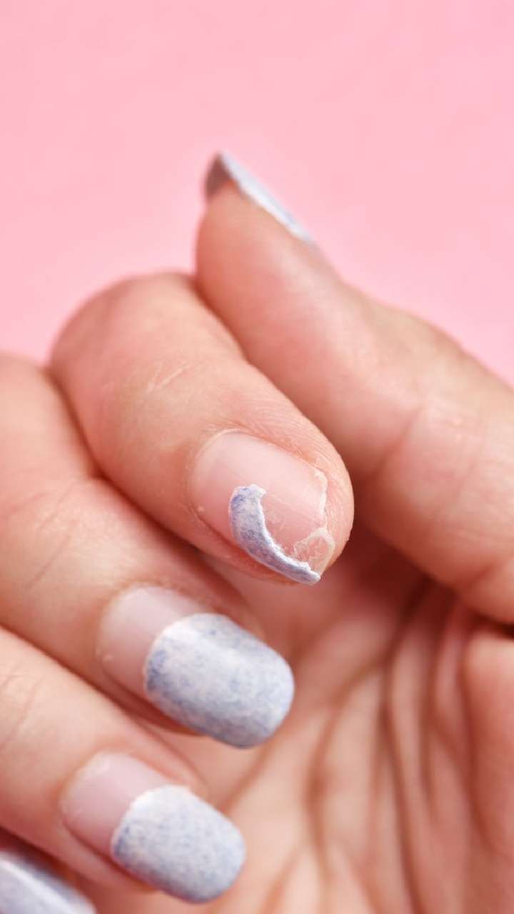 White Spots on Nails (Leukonychia): Causes & Treatment