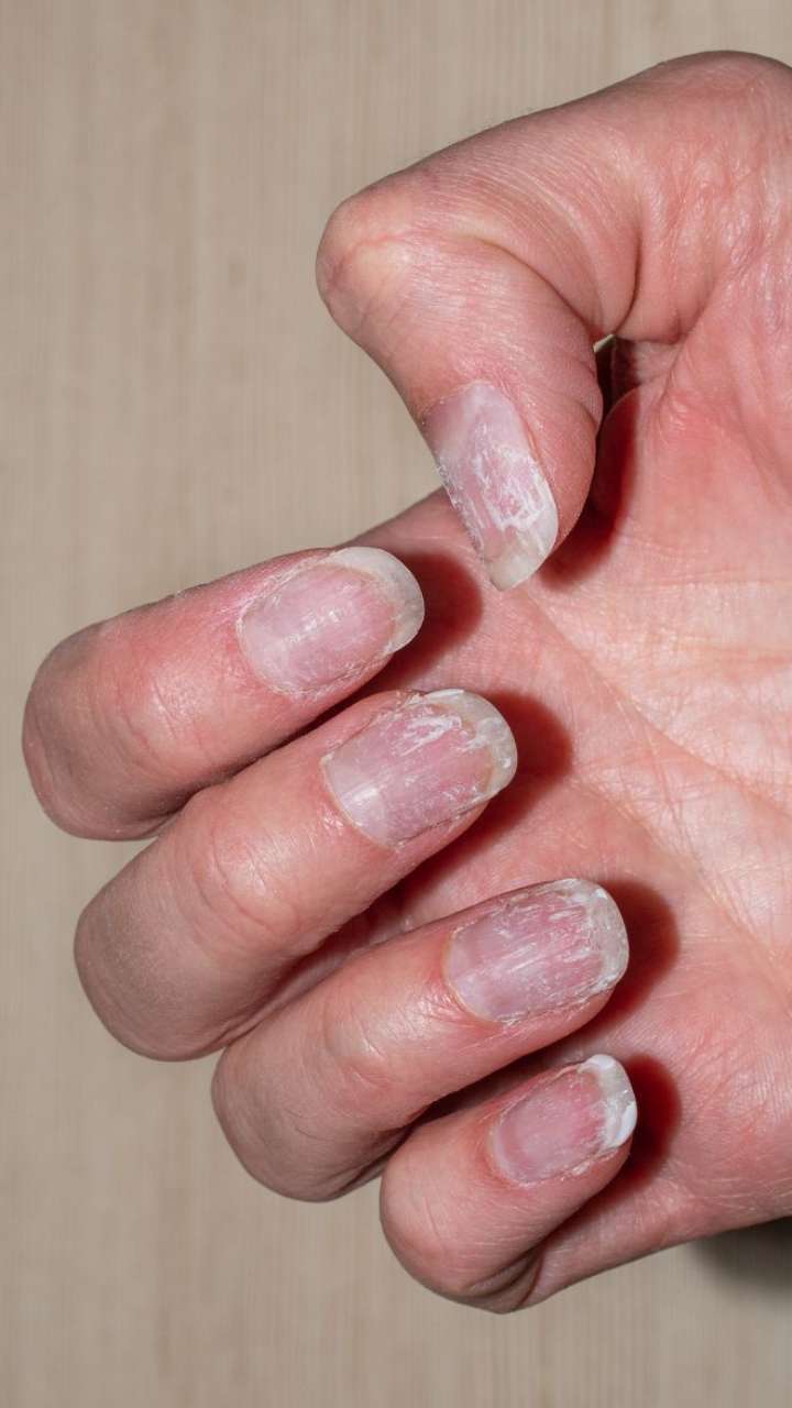 15 Homemade Remedies to Make Your Brittle Nails Strong