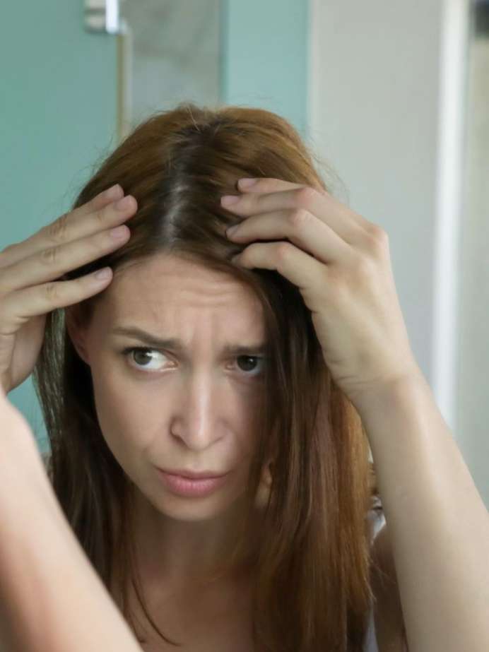 5Step Haircare Routine For Dandruff And Dry Scalp Dandruff Onlymyhealth