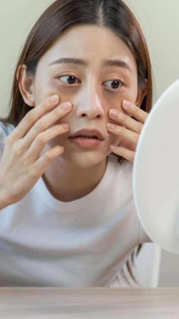 डार्क सर्कल्स दूर करने के लिए ऐसे करें घी और हल्दी का इस्तेमाल