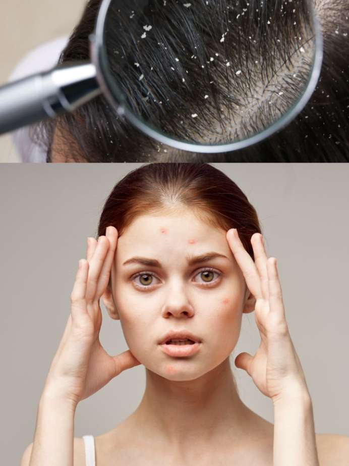 How Dirty Hair Can Affect Skin Health