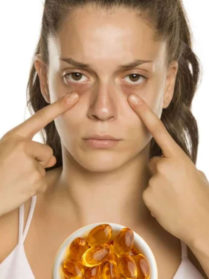 How To Use Vitamin E Tablets For Dark Circles How To Use Vitamin E Tablets For Dark Circles