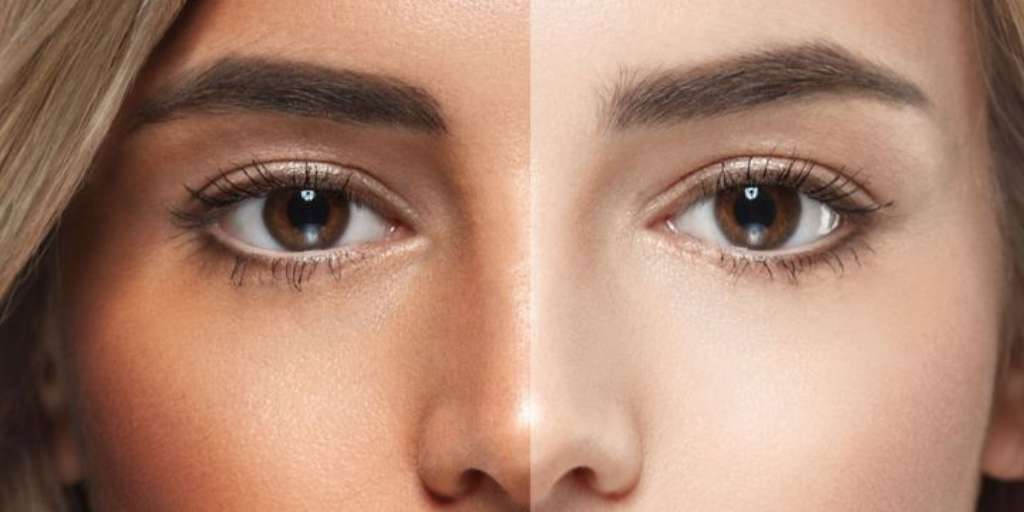 DIY Malai DeTan Face Pack At Home For Oily Skin