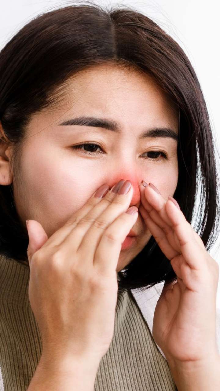 Sinusitis: Types and Causes, Symptoms & Preventions, or Remedies - HubPages