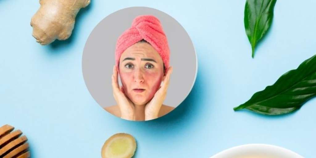 What Is The Best Treatment For Cold Rash Onlymyhealth