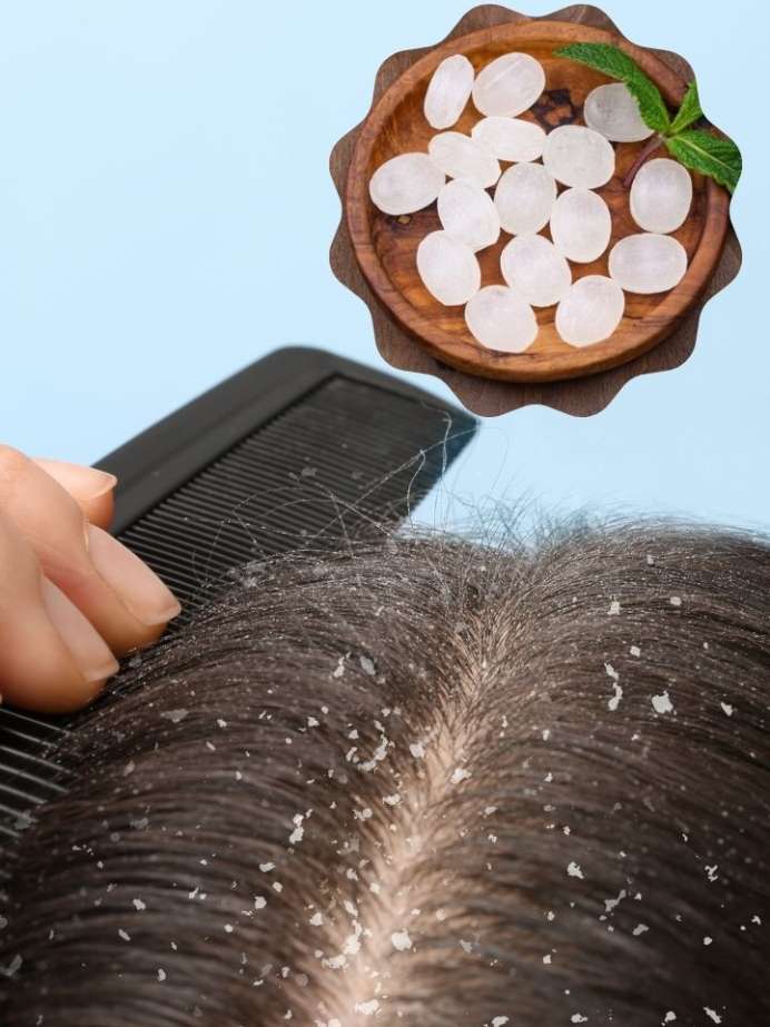 how-to-use-camphor-with-coconut-oil-to-remove-dandruff-onlymyhealth