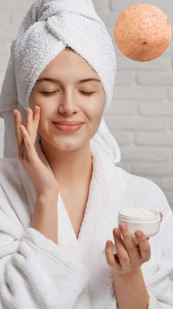 मॉइस्चराइजर से भी त्वचा हो सकती है काली, जानें वजह