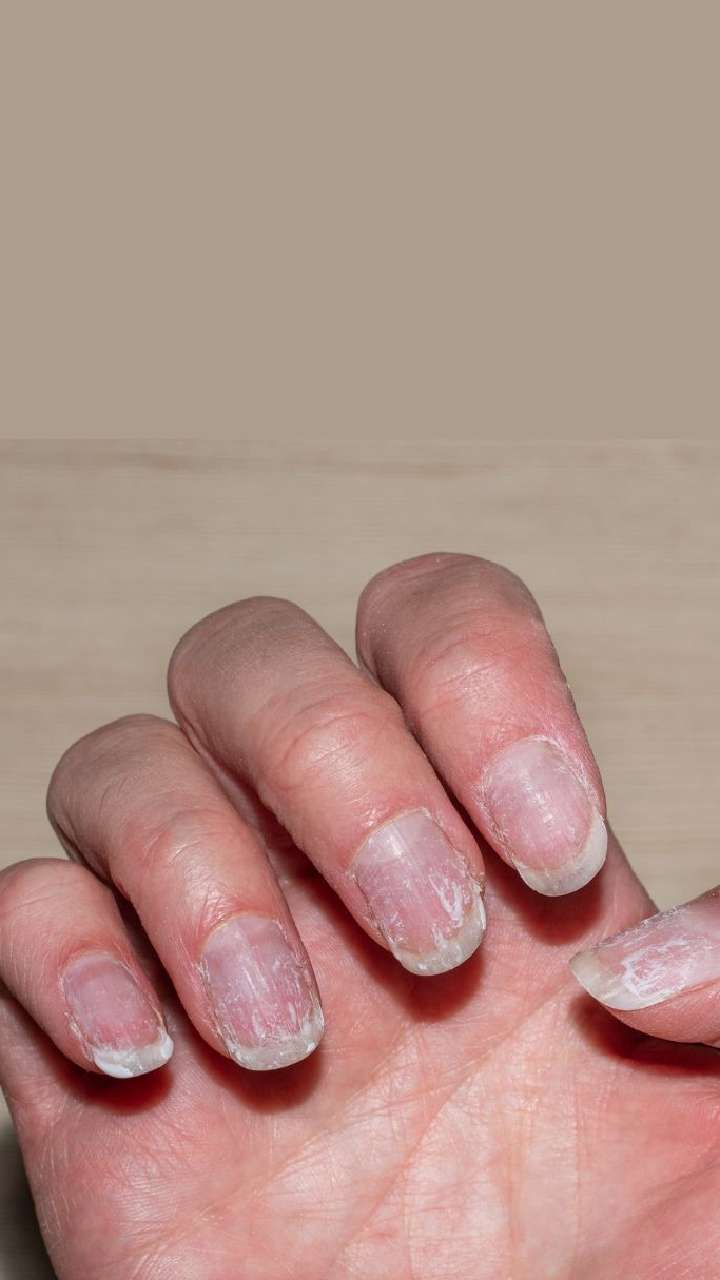 Common Nail Problems & How to Improve Your Nail Health Naturally