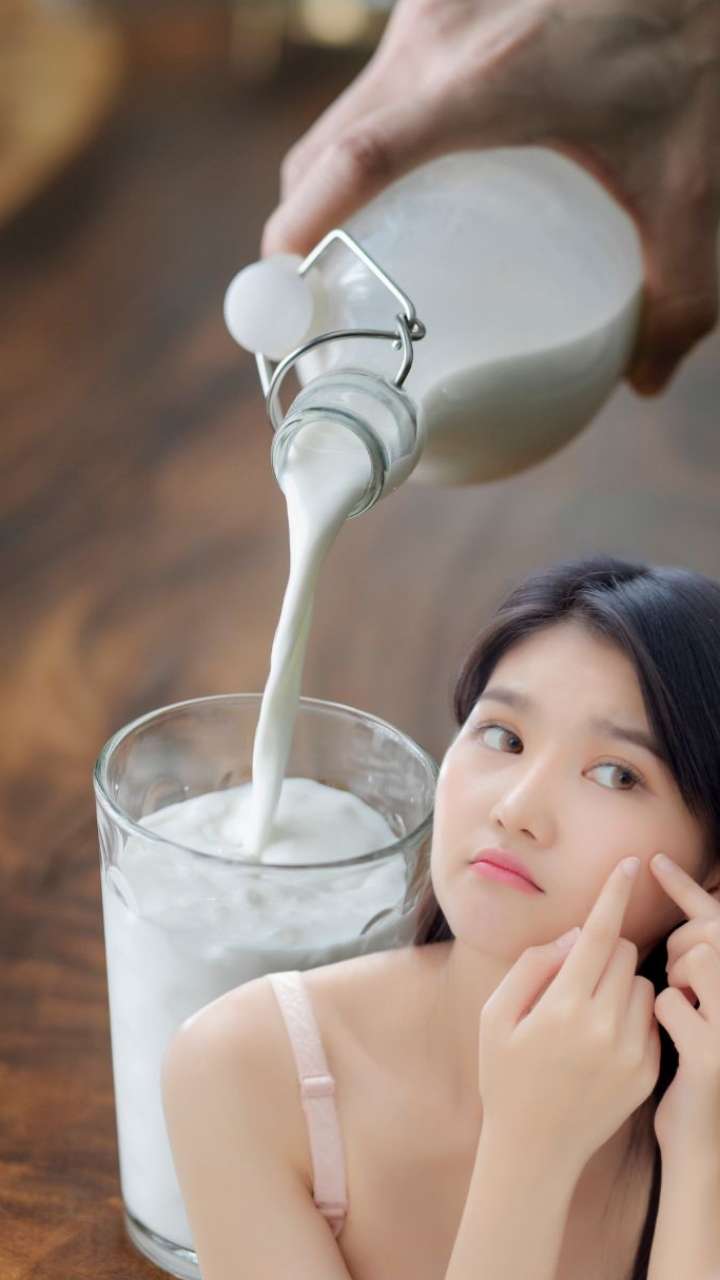 can-milk-cause-acne-know-from-expert