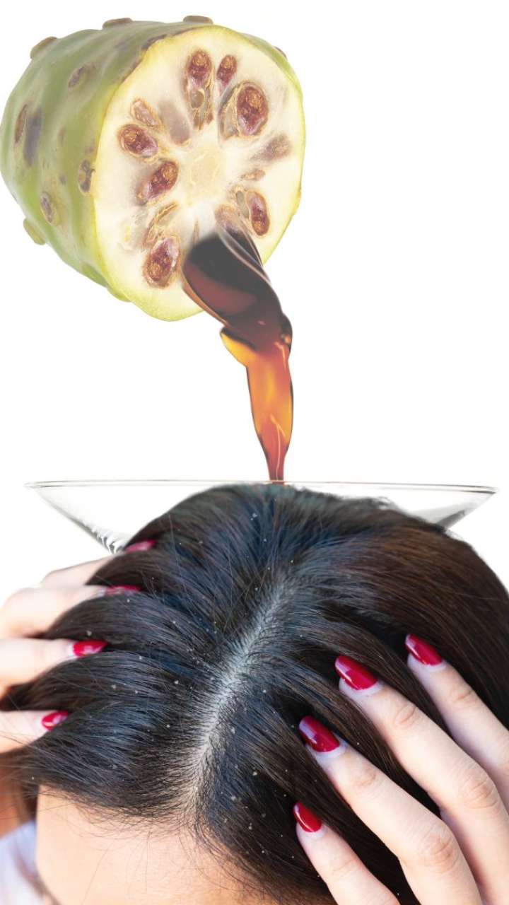 How To Nourish Your Scalp with Noni Juice?