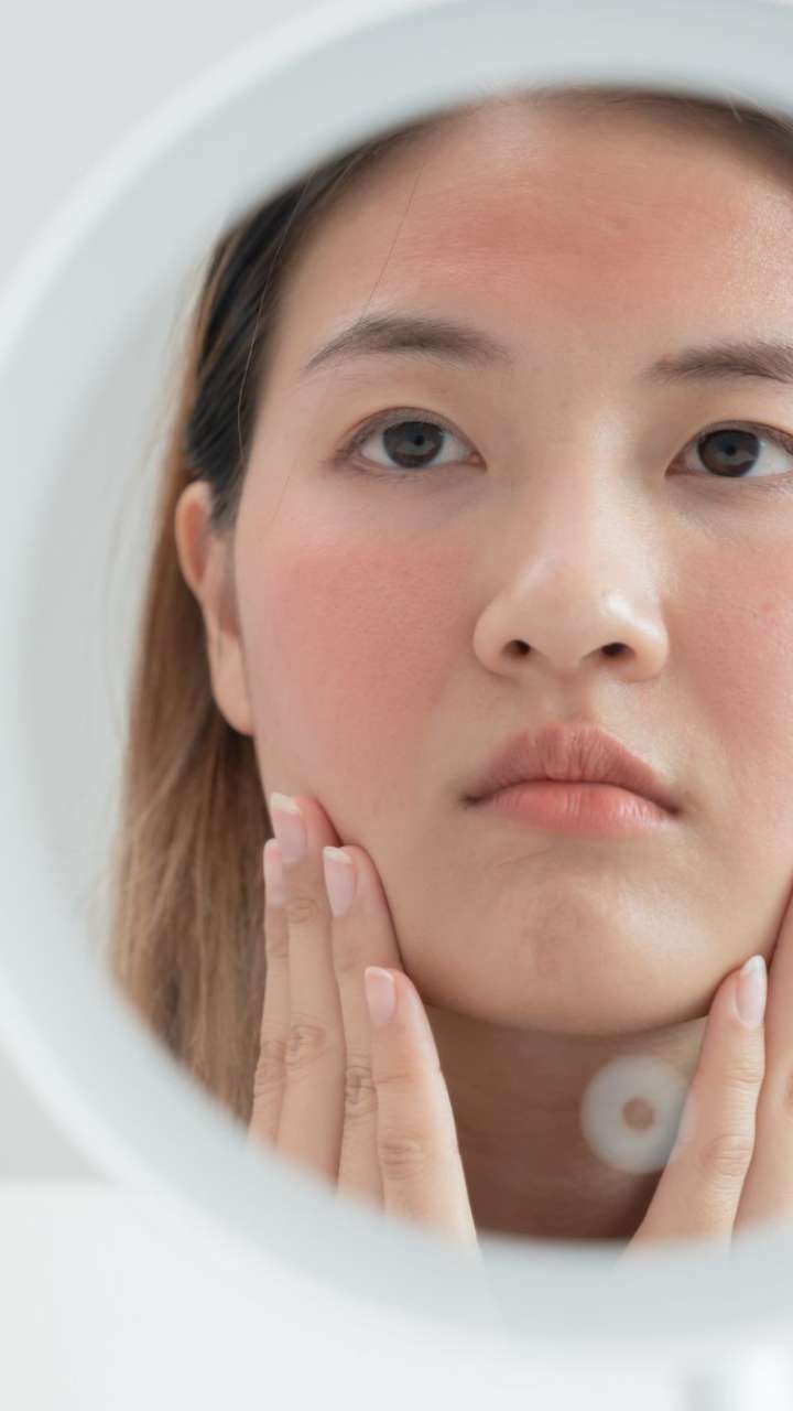 What Is The Main Cause Of Heat Rash?