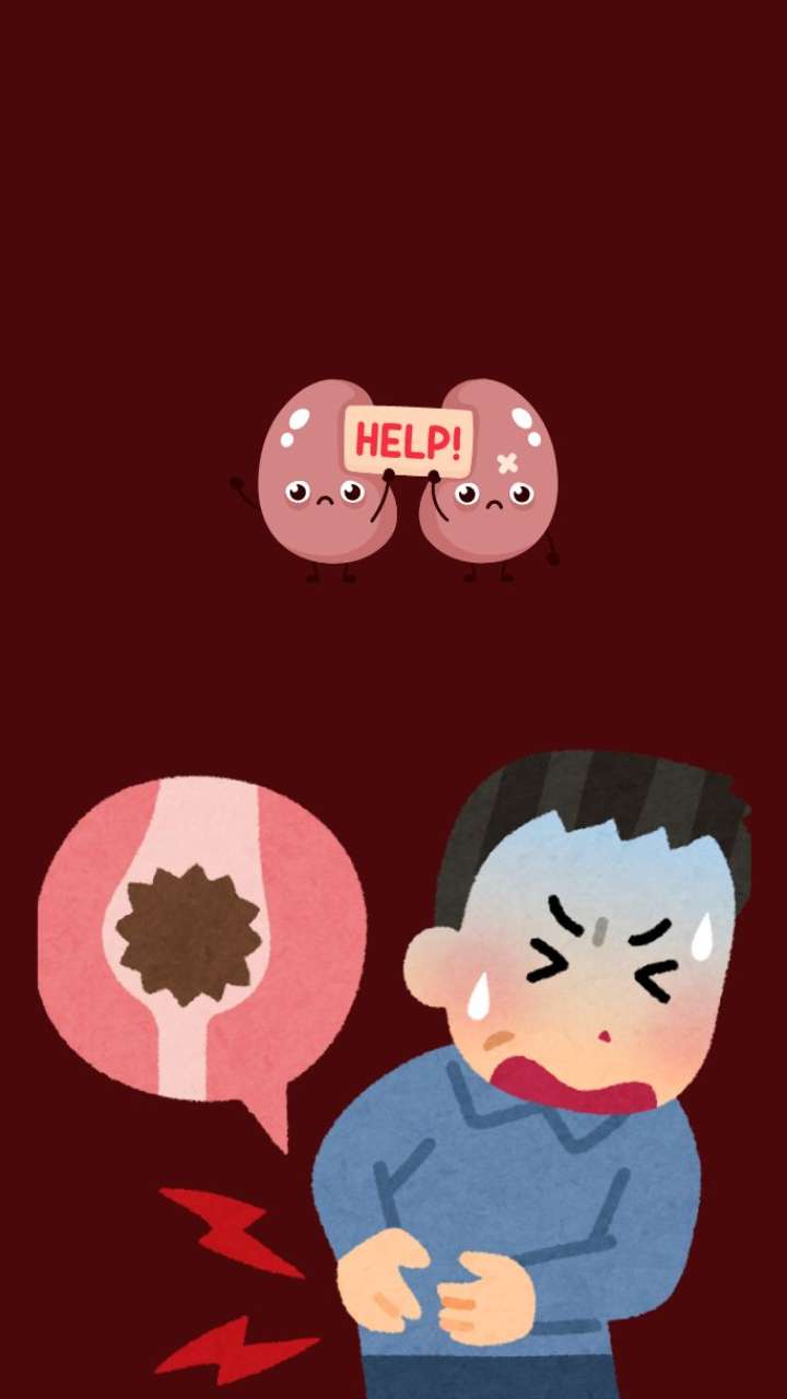 How Kidney Stones Can Be Dangerous?