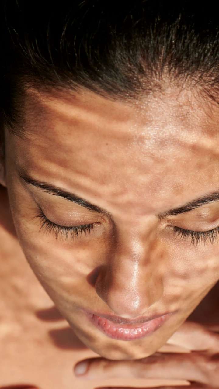 How To Make Your Skin Glow In Summers?