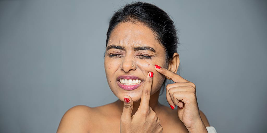 Scar In Hindi at Alvin Webber blog