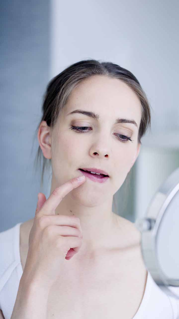 Home Remedies To Treat Chapped Lips