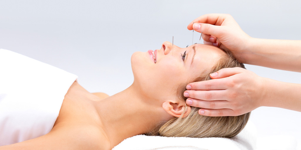 Potential Benefits of Acupuncture Therapy