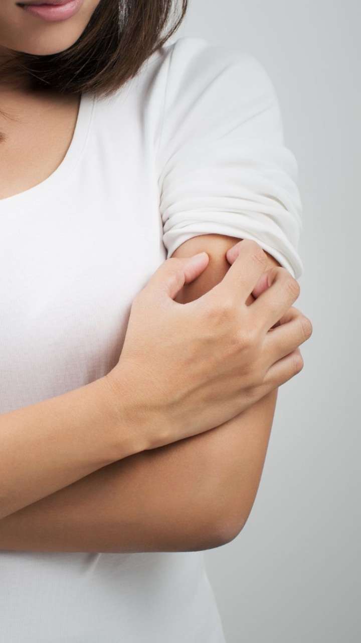 7 Smart Ways To Prevent Mosquito Bites At The Office