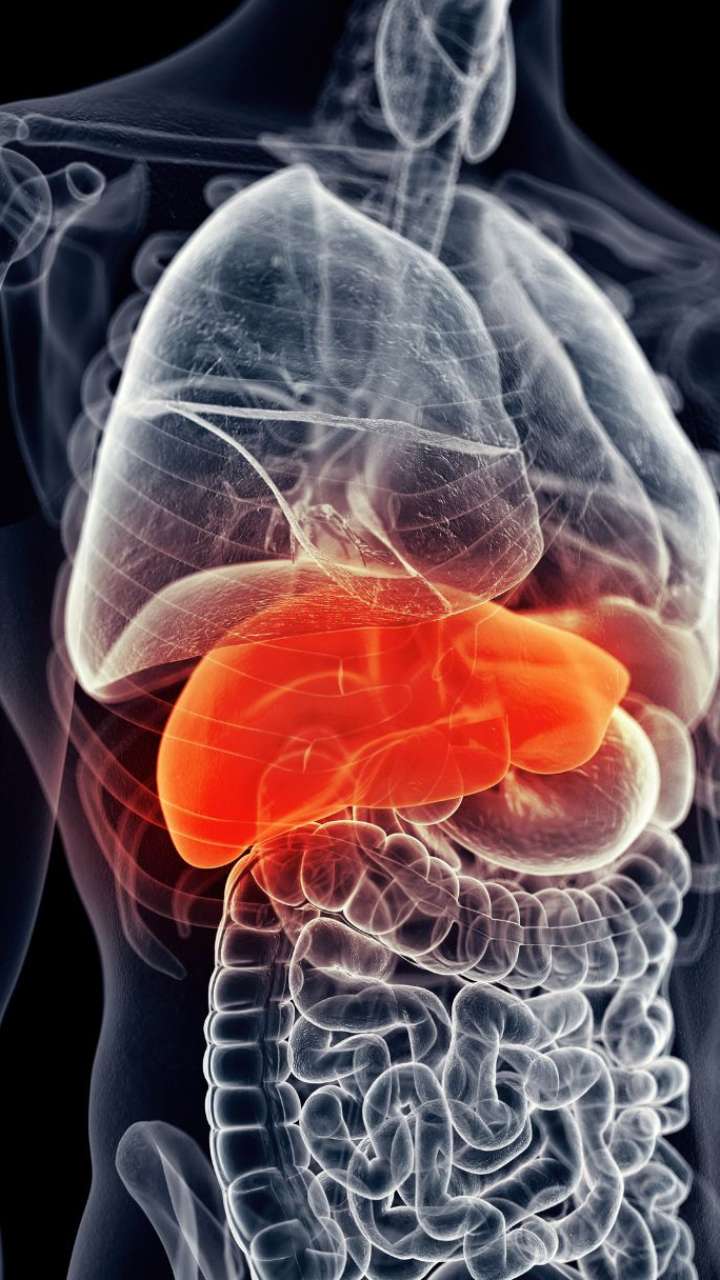 7 Side Effects Of Fatty Liver On Hair