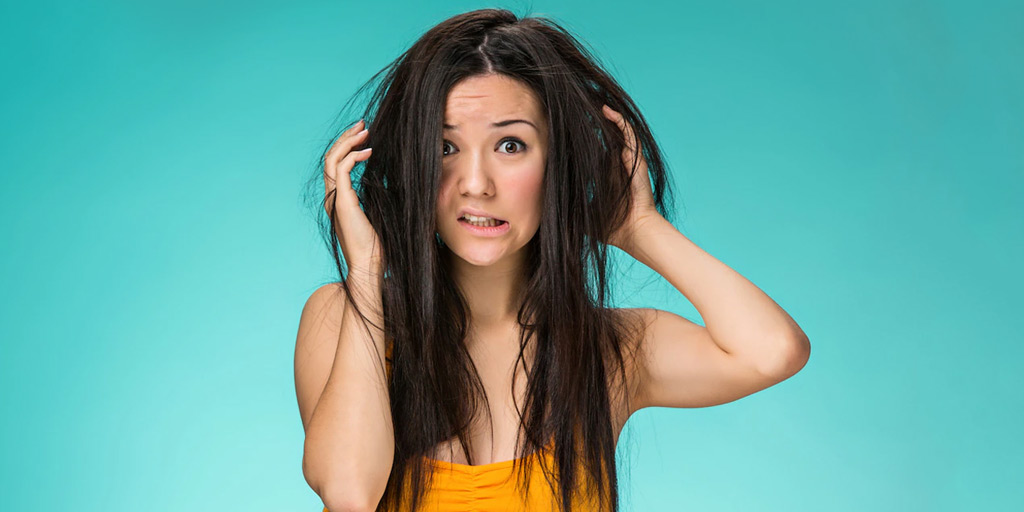 7 Tips To Keep Dandruff Away This Winter