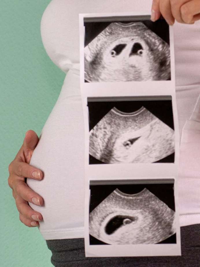 5 First Trimester Exercises Every Expecting Mom Should Do!