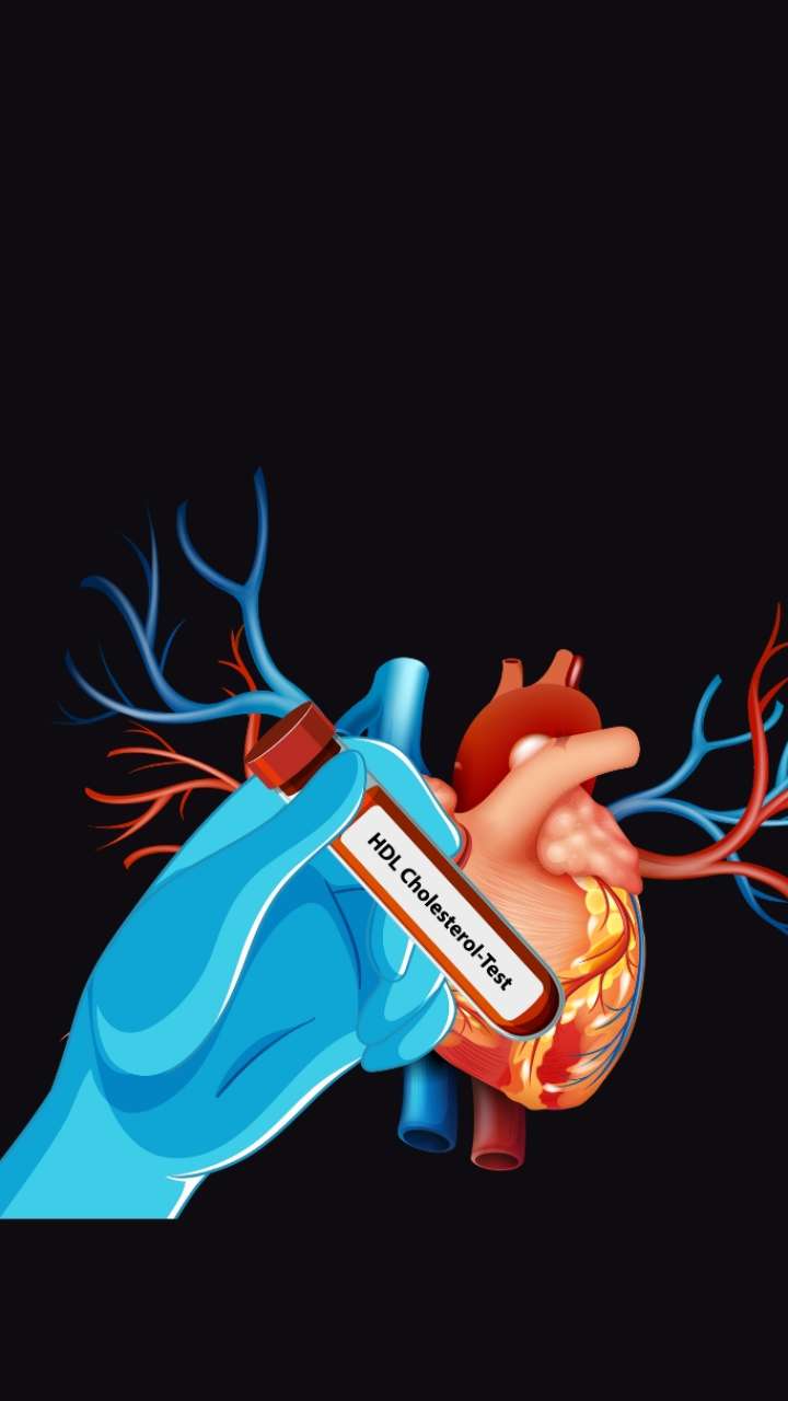 सीरम कोलेस्ट्रॉल क्या होता है? डॉक्टर से जानें