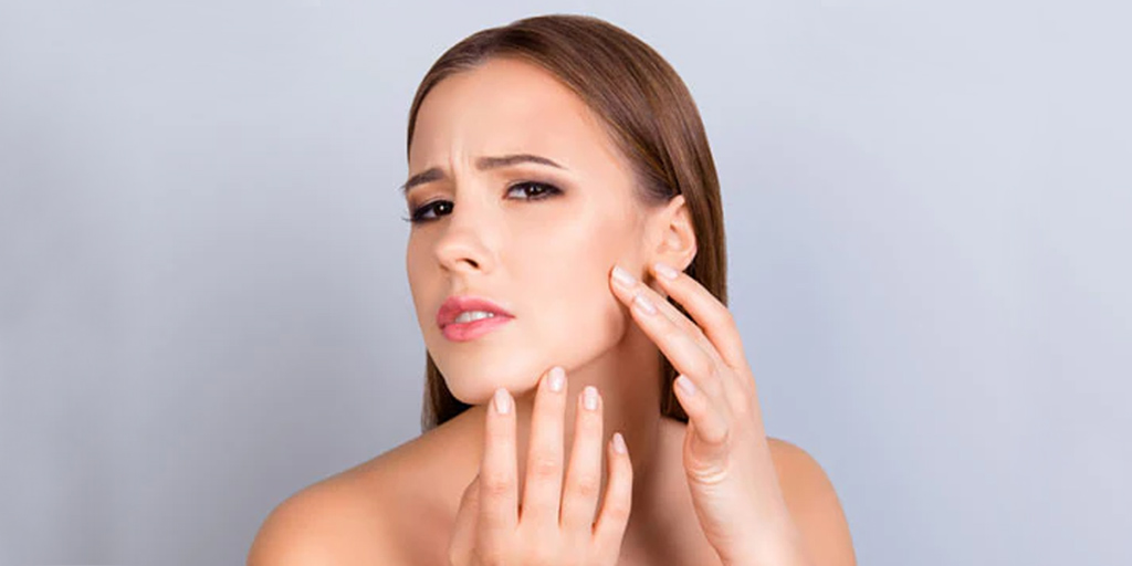 Vitamin E Benefits for Acne Treatment