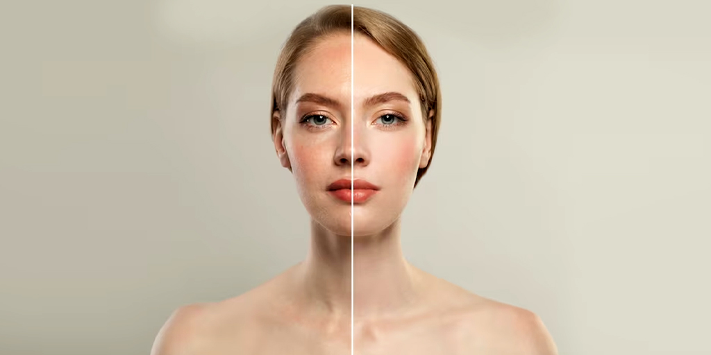 tips-to-fix-skin-pigmentation