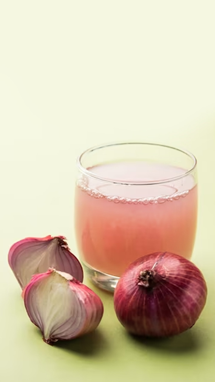 Top 5 Benefits of Onion Juice For Healthy Hair & Scalp – goodvibesonly.in