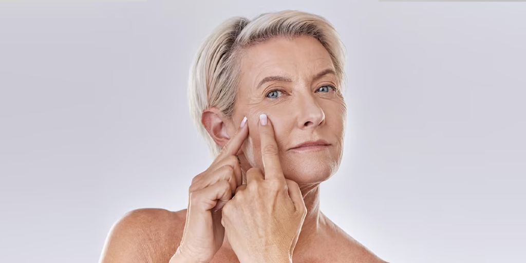 5 Causes Of Acne In Older Women