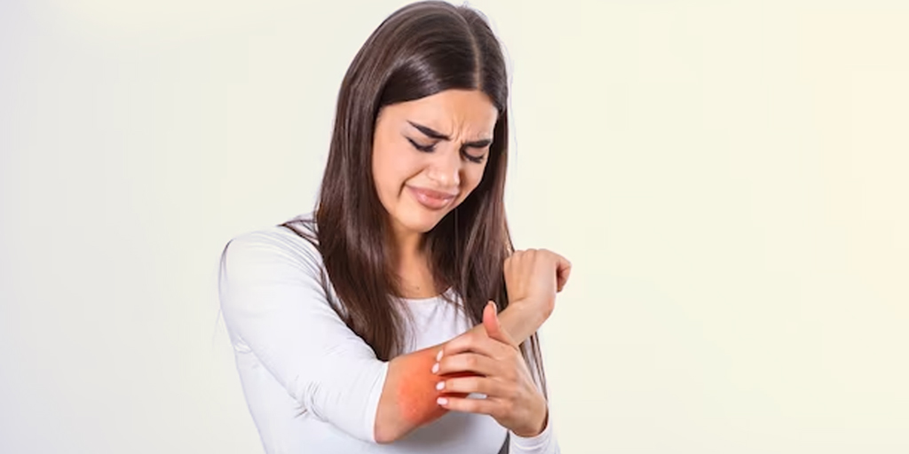 Triggers of eczema