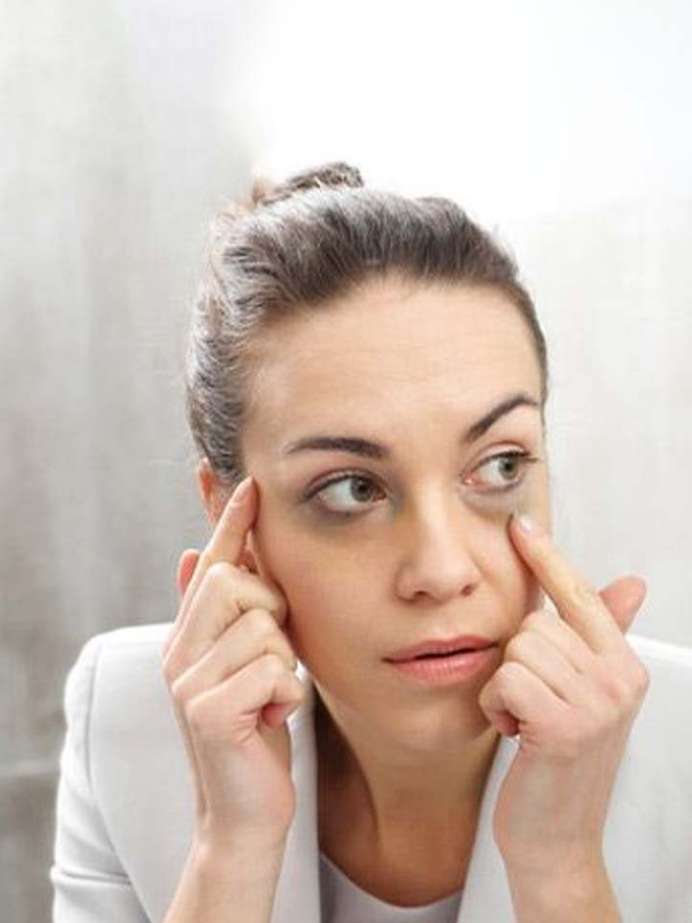 dark-circles-under-the-eyes-are-one-of-the-more-common-beauty-problems